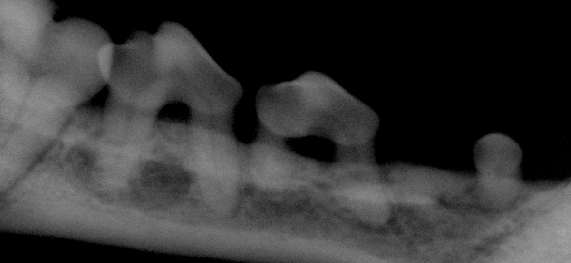 (Dental Radiography)